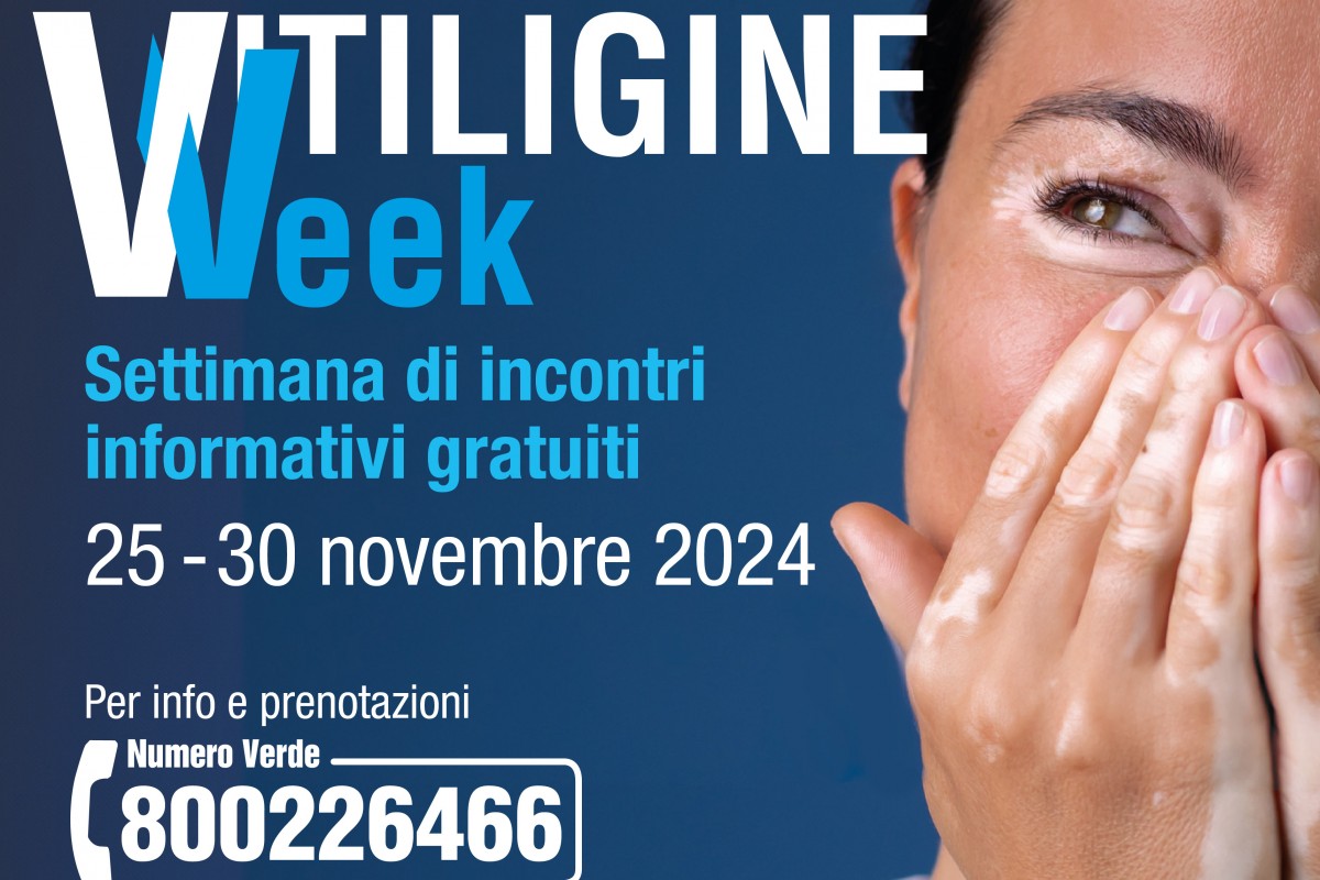 Vitiligine Week:mille incontri gratuiti con i dermatologi