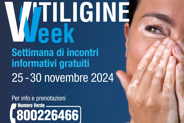 Vitiligine Week:mille incontri gratuiti con i dermatologi